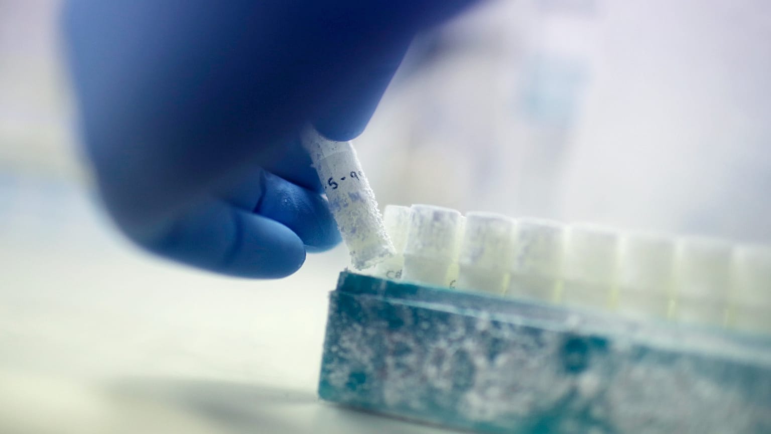 FILE - In this Tuesday, May 15, 2018, photo, scientist Fabrice De Bond picks up a vial containing frozen donor sperm samples in a lab at Melbourne IVF in Melbourne, Australia.
